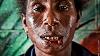 Living Cannibal Victim In Papua New Guinea