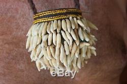 Papua New Guinea Tribal Dolphin Teeth Witchdoctor Bag Medicine